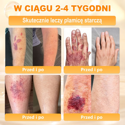 🌸🌸VLSVLS® Jad Pszczoły Kompleksowy Krem🥇pomaga w leczeniu problemów skórnych, takich jak: zmarszczki, blizny, plamy pigmentacyjne, rozstępy, trądzik, łuszczyca, egzema, zmiany skórne, podrażnienia, stany zapalne i inne problemy skórne🔥