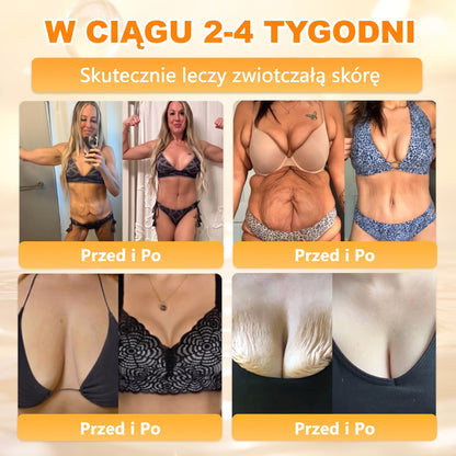 🌸🌸VLSVLS® Jad Pszczoły Kompleksowy Krem🥇pomaga w leczeniu problemów skórnych, takich jak: zmarszczki, blizny, plamy pigmentacyjne, rozstępy, trądzik, łuszczyca, egzema, zmiany skórne, podrażnienia, stany zapalne i inne problemy skórne🔥