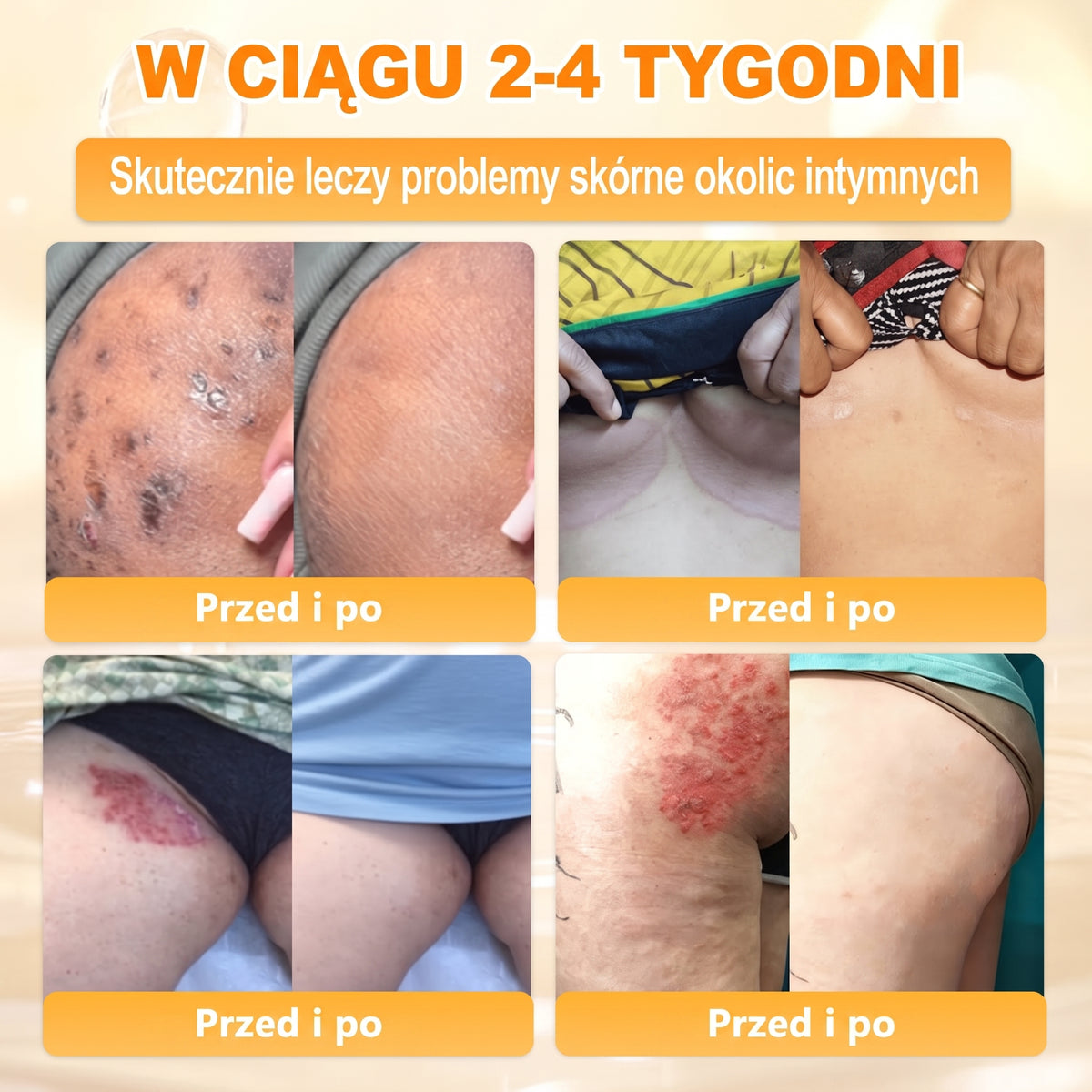 🌸🌸VLSVLS® Jad Pszczoły Kompleksowy Krem🥇pomaga w leczeniu problemów skórnych, takich jak: zmarszczki, blizny, plamy pigmentacyjne, rozstępy, trądzik, łuszczyca, egzema, zmiany skórne, podrażnienia, stany zapalne i inne problemy skórne🔥