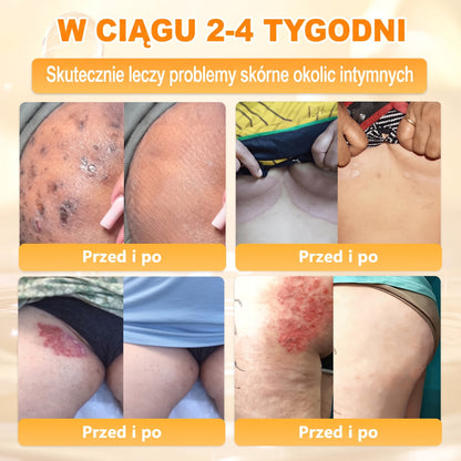 🌸🌸VLSVLS® Jad Pszczoły Kompleksowy Krem🥇pomaga w leczeniu problemów skórnych, takich jak: zmarszczki, blizny, plamy pigmentacyjne, rozstępy, trądzik, łuszczyca, egzema, zmiany skórne, podrażnienia, stany zapalne i inne problemy skórne🔥