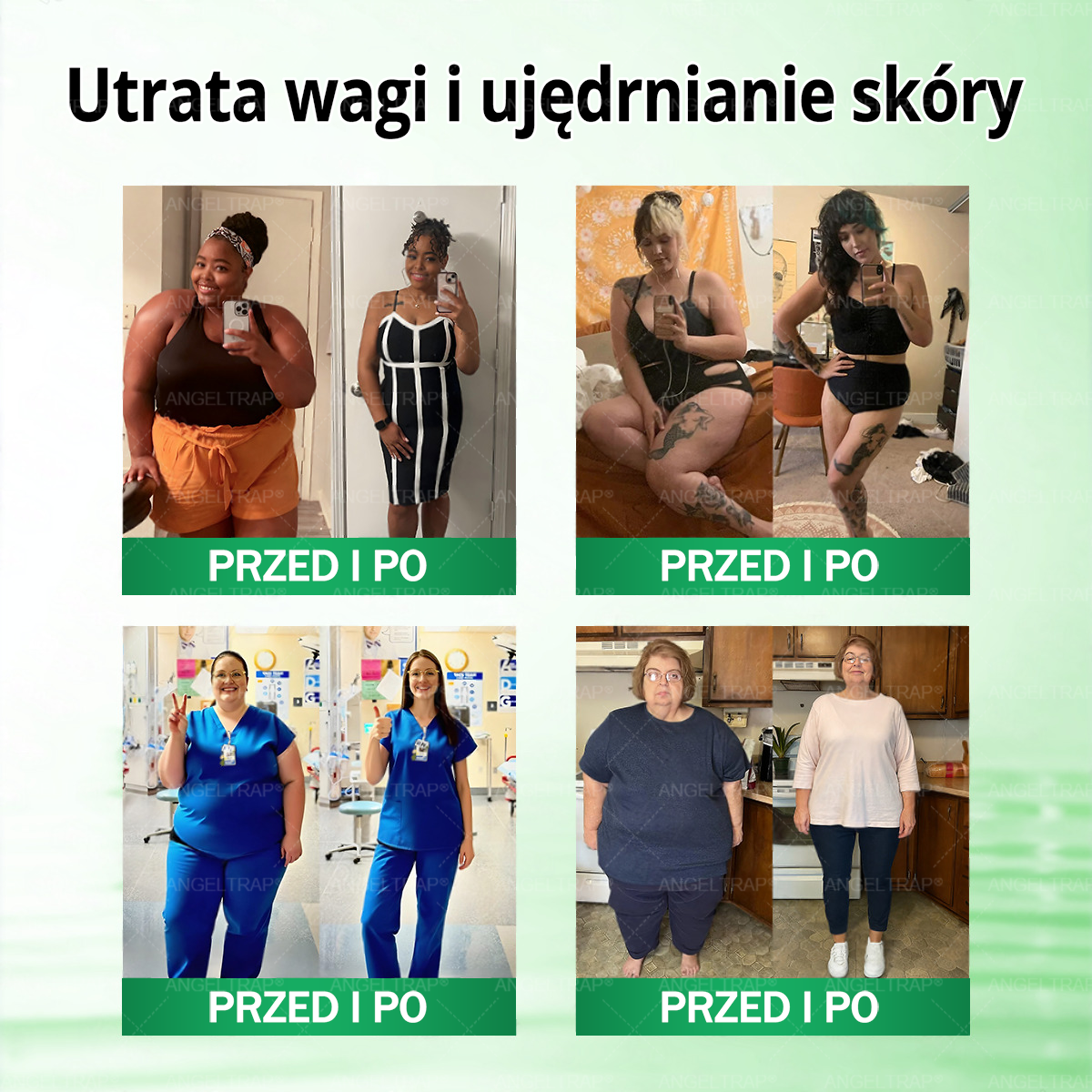 ANGELTRAP® Moringa × Berberyna × AMPK 10-w-1 Wsparcie metaboliczne, plaster z nanotechnologią mikroigłową 🇵🇱(Wystarczy raz dziennie, widoczne efekty w 7 dni) ✅ Na otyłość, wiotką skórę, cukrzycę, bezdech senny, problemy ze stawami i wiele innych
