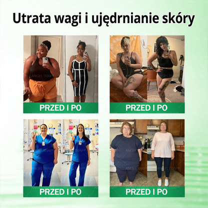 ANGELTRAP® Moringa × Berberyna × AMPK 10-w-1 Wsparcie metaboliczne, plaster z nanotechnologią mikroigłową 🇵🇱(Wystarczy raz dziennie, widoczne efekty w 7 dni) ✅ Na otyłość, wiotką skórę, cukrzycę, bezdech senny, problemy ze stawami i wiele innych