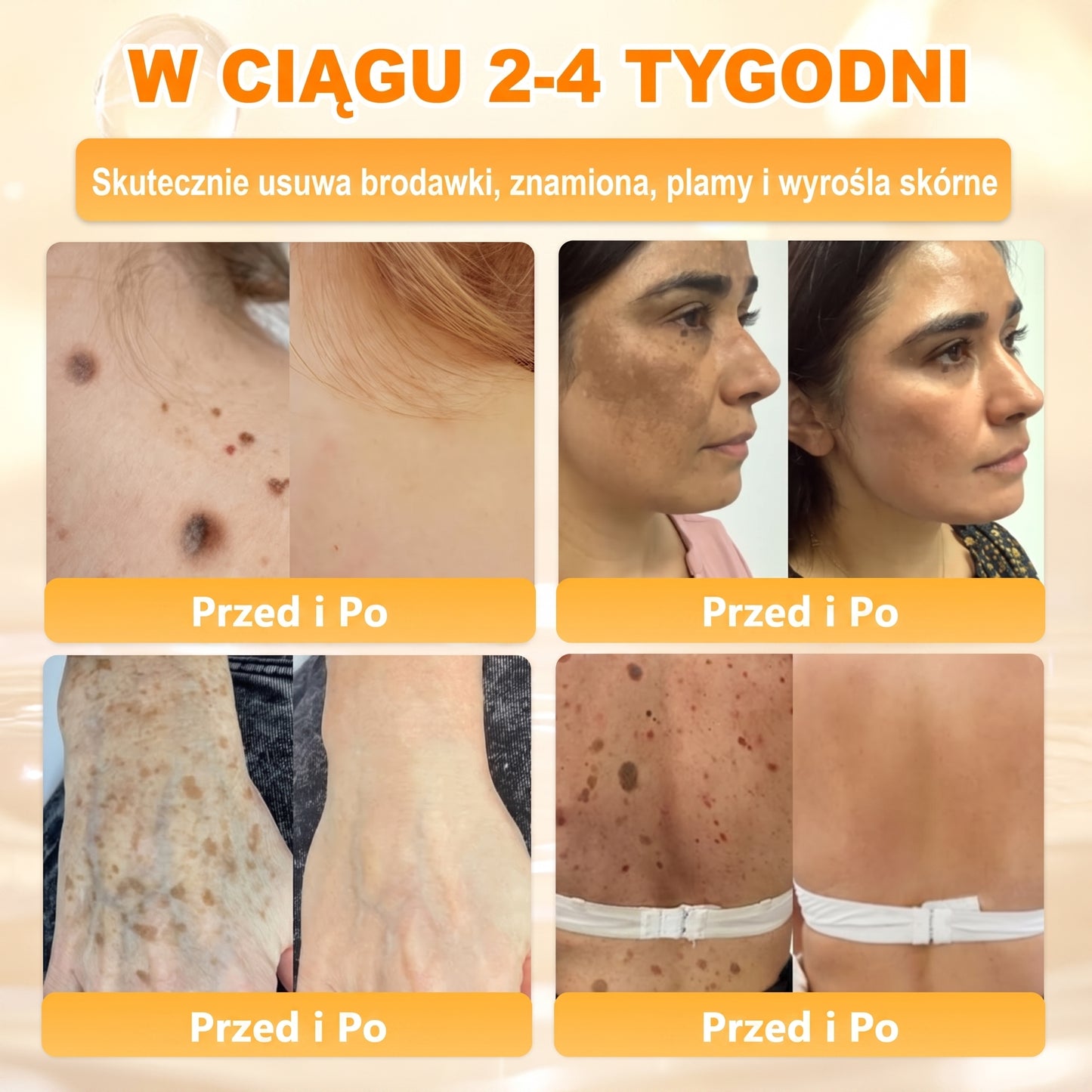 🌸🌸VLSVLS® Jad Pszczoły Kompleksowy Krem🥇pomaga w leczeniu problemów skórnych, takich jak: zmarszczki, blizny, plamy pigmentacyjne, rozstępy, trądzik, łuszczyca, egzema, zmiany skórne, podrażnienia, stany zapalne i inne problemy skórne🔥