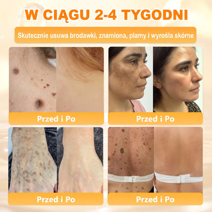 🌸🌸VLSVLS® Jad Pszczoły Kompleksowy Krem🥇pomaga w leczeniu problemów skórnych, takich jak: zmarszczki, blizny, plamy pigmentacyjne, rozstępy, trądzik, łuszczyca, egzema, zmiany skórne, podrażnienia, stany zapalne i inne problemy skórne🔥